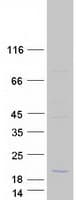 Human C11orf86 Protein (Recombinant Myc-DDK (Flag))