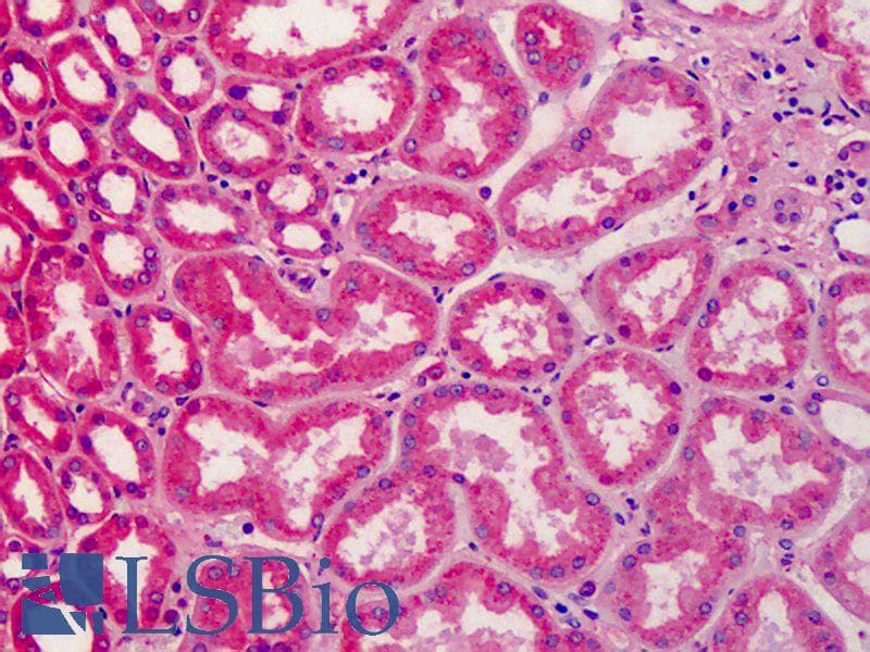 IHC-plus™ Polyclonal Rabbit anti-Human Apolipoprotein A-II Antibody (IHC, WB)