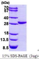 Human COL4A3BP / CERT Protein (Recombinant His)