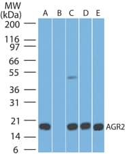 IHC-plus™ AGR2 Antibody (aa50-100, clone IMG10E2)