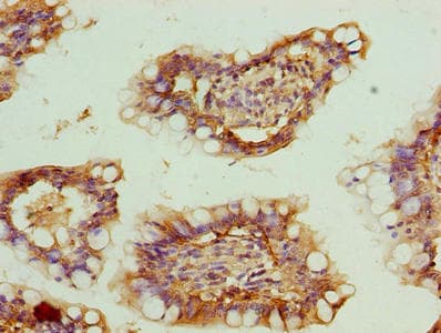 ZNF281 / Zfp281 Antibody