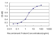IHC-plus™ RICK / RIP2 Antibody (clone 7F5)