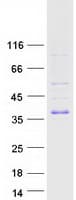 Human TIRAP Protein (Recombinant Myc-DDK (Flag))