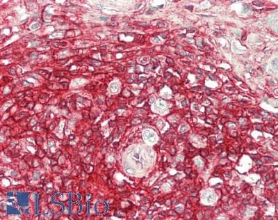 PathPlus™ CD44 Antibody (aa1-258)