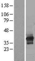 Human C6orf106 Protein (Over-Expression Lysate Myc-DDK (Flag))