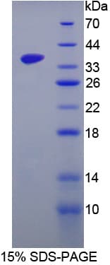 Mouse SRPK3 / MSSK1 Protein (Recombinant His-T7)