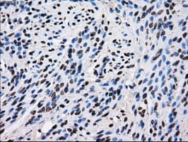 Monoclonal Mouse anti-Human ID3 Antibody (clone OTI12C7, IHC, IF, WB)
