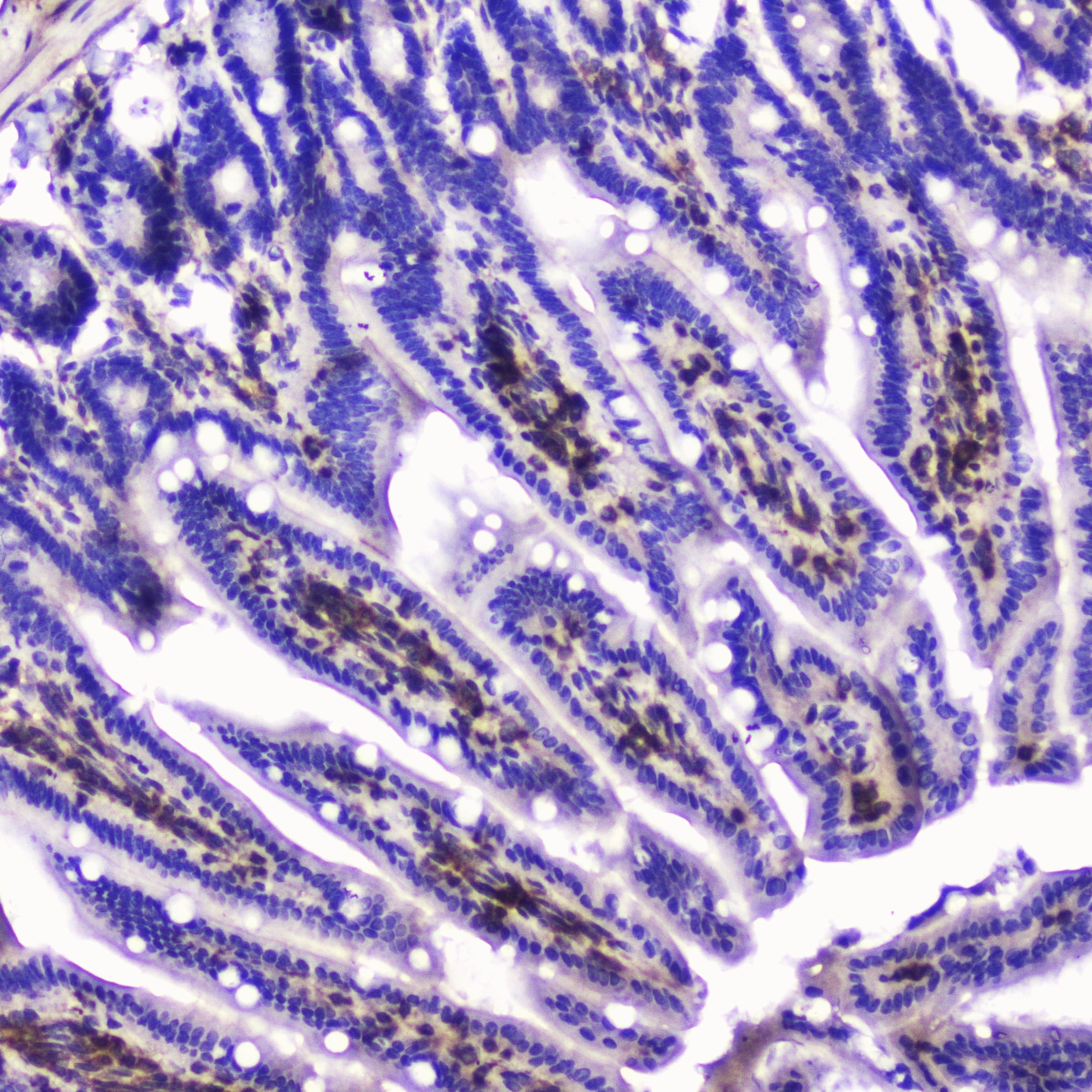 TLN1 / Talin 1 Antibody