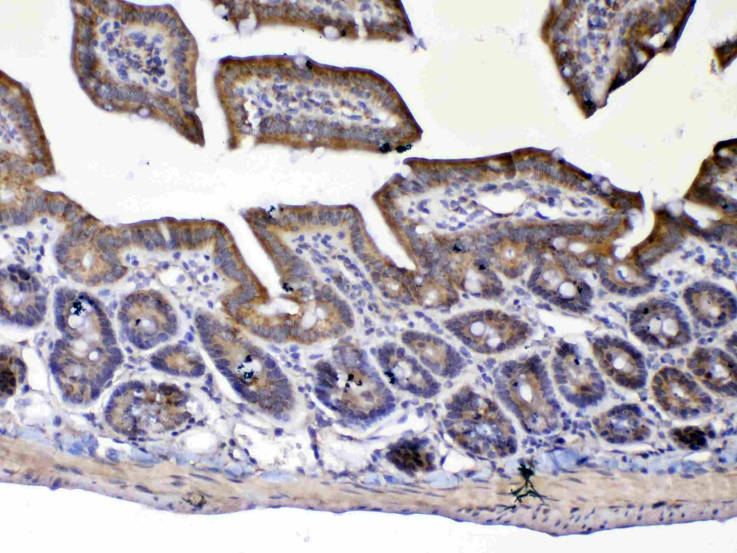 UGT1A / UGT1A1 Antibody