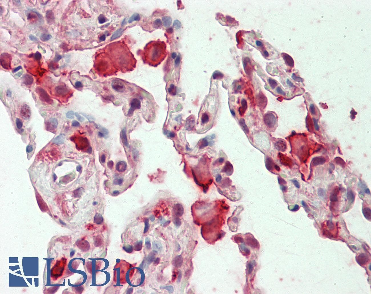 IHC-plus™ Polyclonal Goat anti-Human CAPG Antibody (aa147-159, IHC, WB)