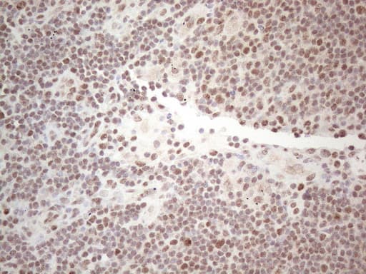 MLH1 Antibody (aa299-527, clone UMAB191)
