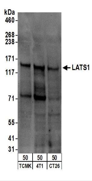 LATS1 Antibody (aa1075-C-term)