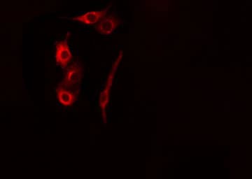 CASP5 / Caspase 5 Antibody