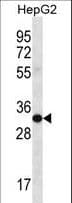 M-PST / STM Antibody (aa71-99)