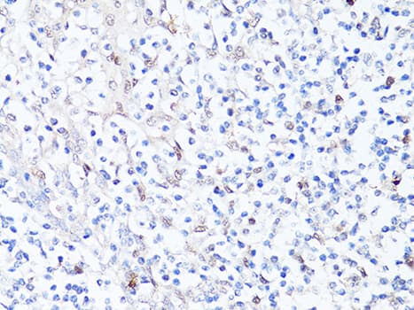 SQSTM1 Antibody