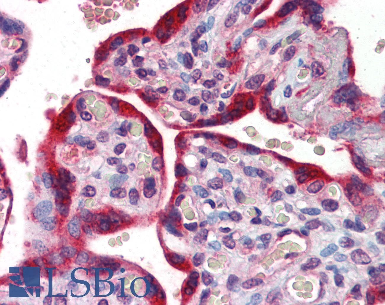 ABCB4 / MDR3 Antibody (aa252-301)
