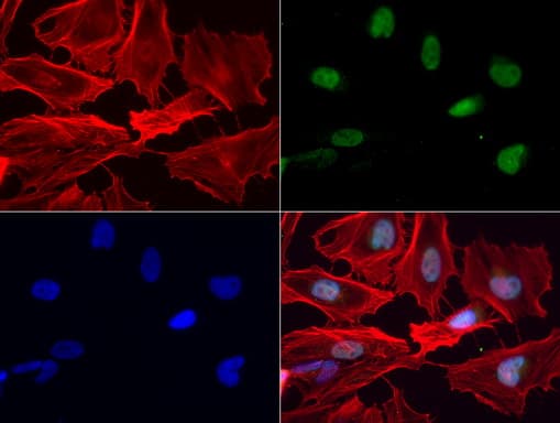 NKX3-1 Antibody (clone UMAB196)