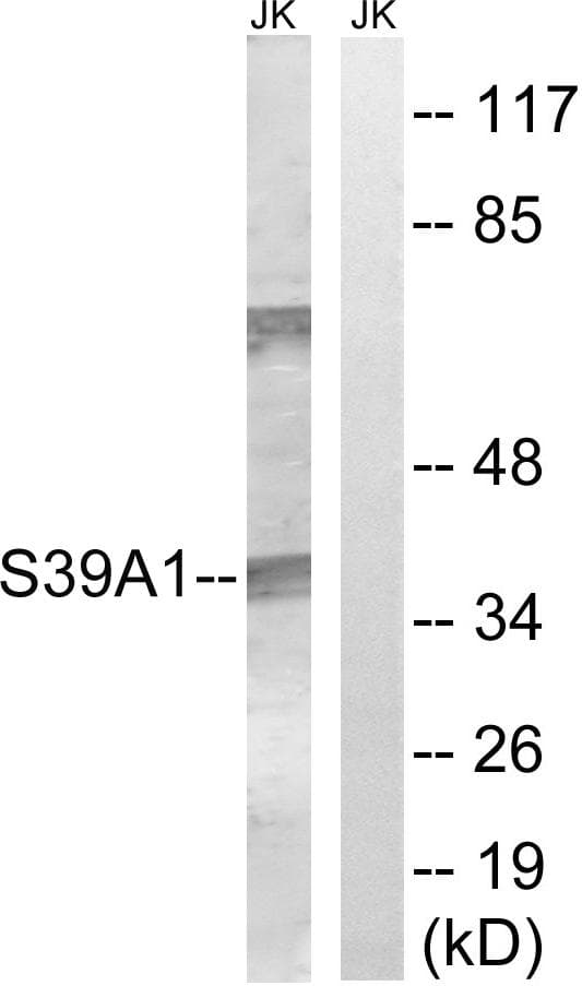 SLC39A1 Antibody