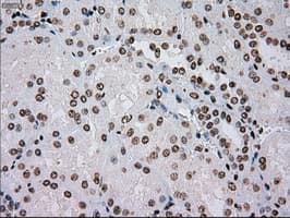 TYRO3 Antibody (clone OTI5B4)