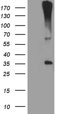 HSD17B3 Antibody (aa49-268, clone OTI7F7)