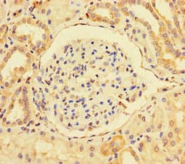 Polyclonal Rabbit anti-Human BMI1 / PCGF4 Antibody (IHC, WB)