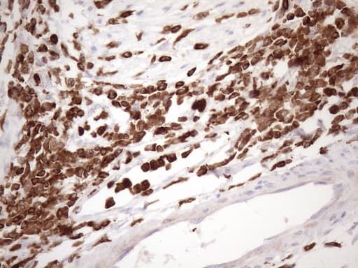 URP2 / FERMT3 Antibody (aa259-528, clone OTI3C7)