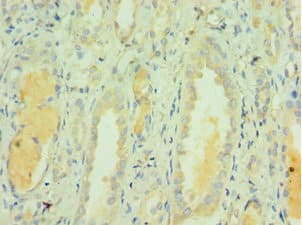 CLEC3B / Tetranectin Antibody (aa22-202)