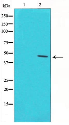 TP53 / p53 Antibody (phospho-Ser46)