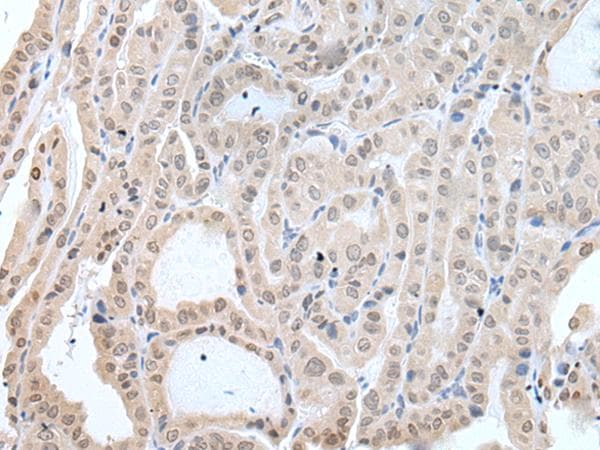 IFN Beta / Interferon Beta Antibody