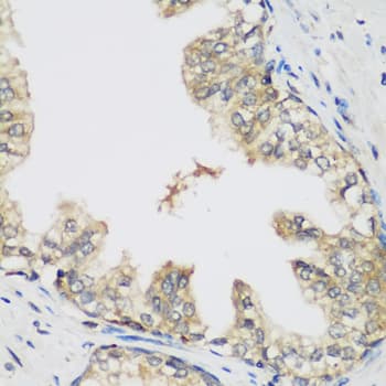 R1 / RRM1 Antibody