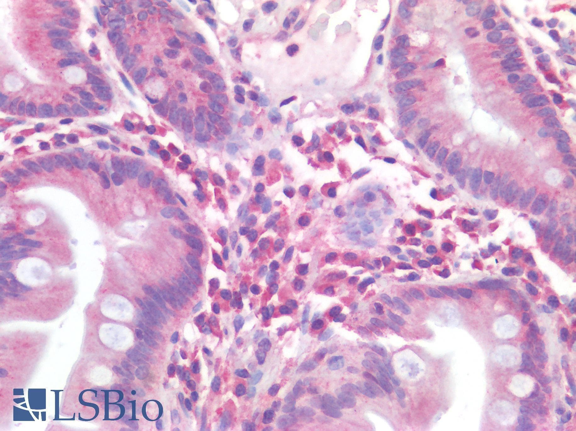 IHC-plus™ Polyclonal Rabbit anti-Human CD63 Antibody (IHC)
