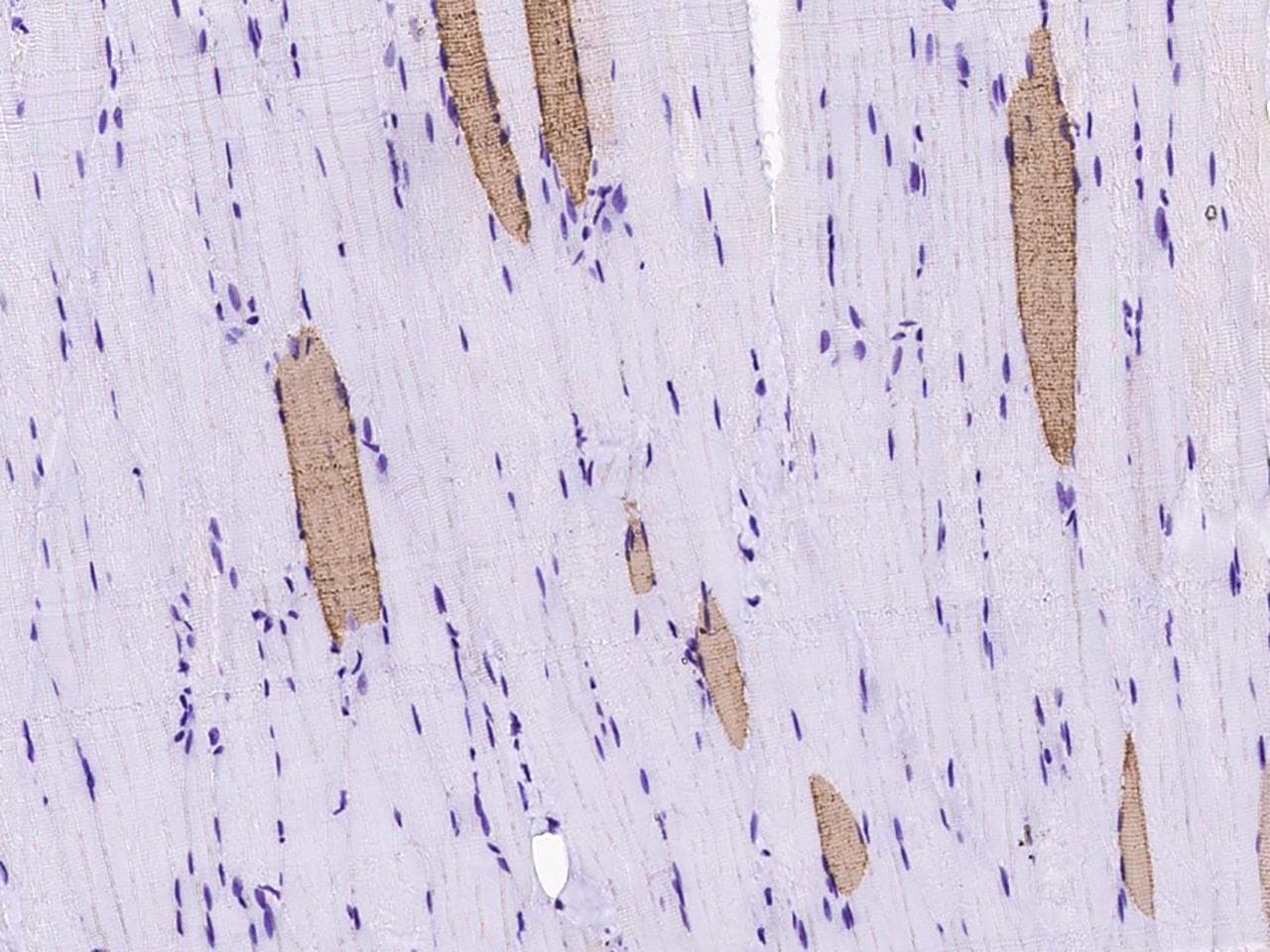 Polyclonal Rabbit anti-Mouse MYL2 Antibody (IHC, WB)