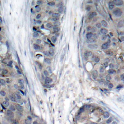 IRS1 Antibody (phospho-Ser307)