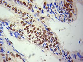 LMNA / Lamin A+C Antibody