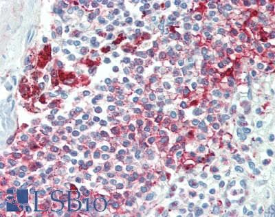 IHC-plus™ NLRP7 / NALP7 Antibody