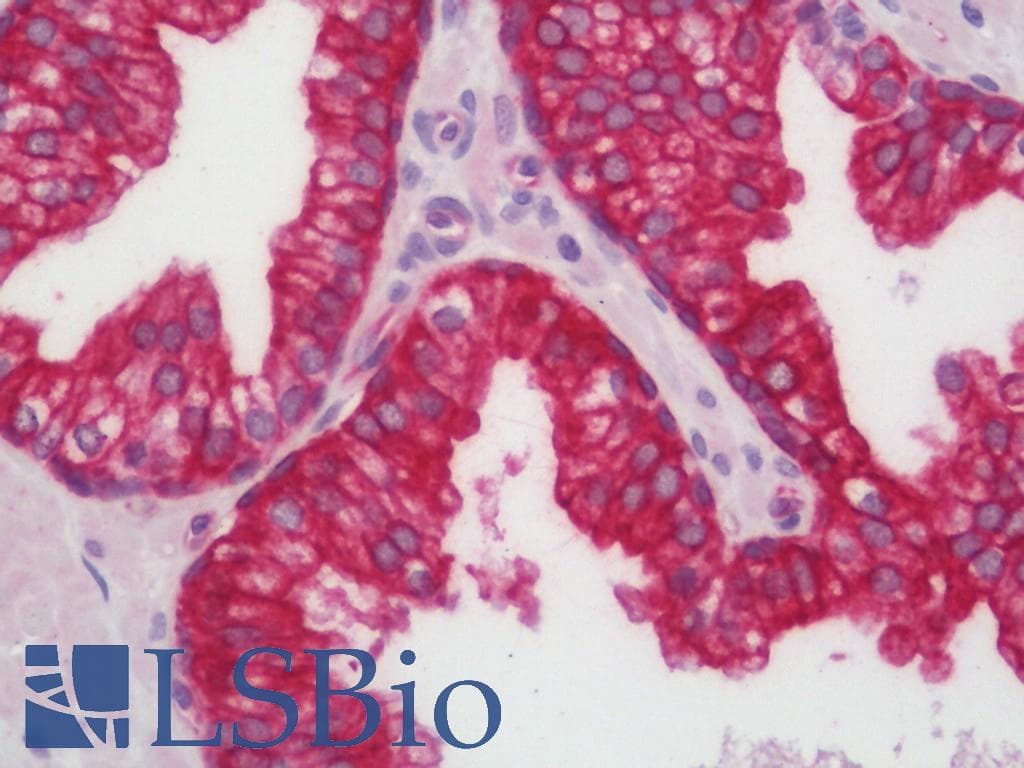 IHC-plus™ KRT8 / CK8 / Cytokeratin 8 Antibody (aa41-90)