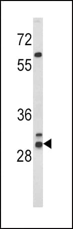 Polyclonal Rabbit anti-Human HLA-DRB1 Antibody (aa30-58, IHC, WB)