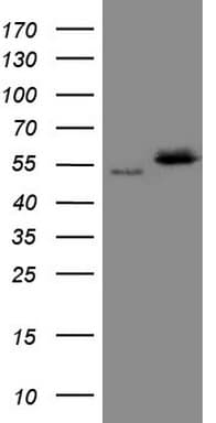 Monoclonal Mouse anti-Human NOB1 / NOB1P Antibody (clone OTI2F5, aa2-234, WB)