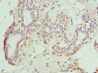 Polyclonal Rabbit anti-Human NOX5 Antibody (IHC, IF)