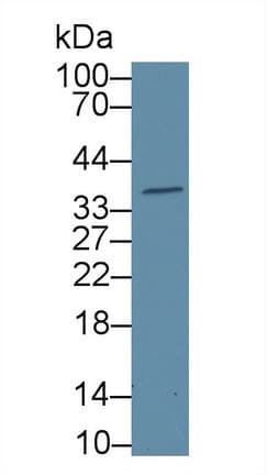 GAL4 / Galectin 4 Antibody (aa1-323)