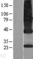 ICMT / PPMT Protein (Over-Expression Lysate Myc-DDK (Flag))