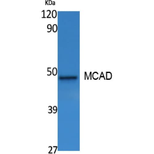 MCAD / ACADM Antibody (Internal)