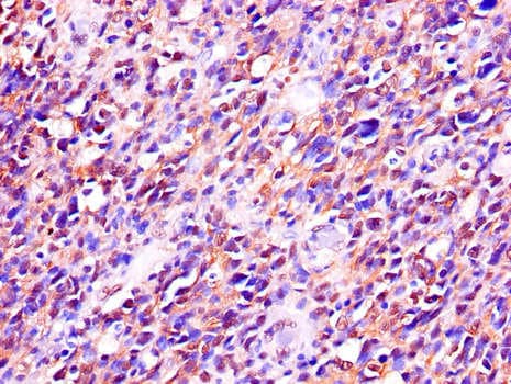 RTCB / C22orf28 Antibody