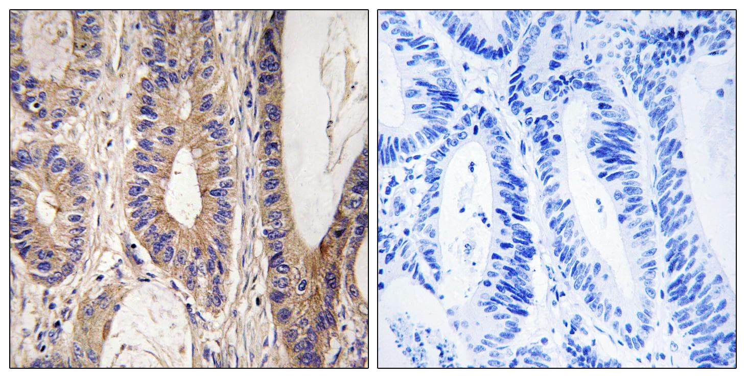 RENT1 / UPF1 Antibody