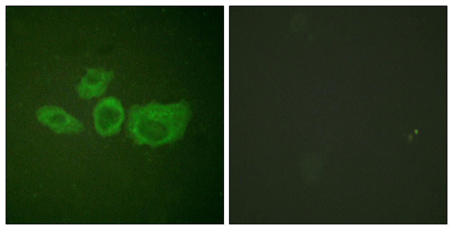 Polyclonal Rabbit anti-Human TH / Tyrosine Hydroxylase Antibody (p40, IHC, IF, WB)
