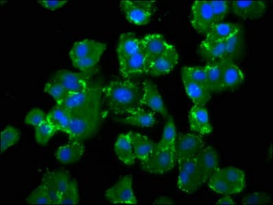 NEDD4L / NEDD4-2 Antibody