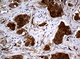 NME1 / NM23 Antibody (clone OTI7D6)