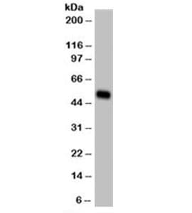 KRT14 / CK14 / Cytokeratin 14 Antibody (C-Terminus, clone LL002, Azide-free, BSA-free)