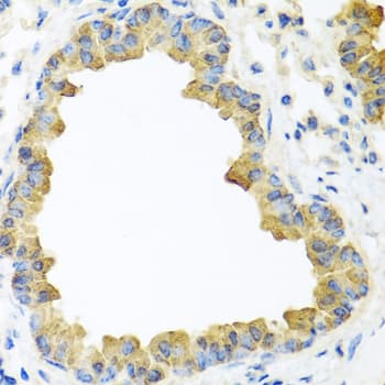 WNT5B Antibody