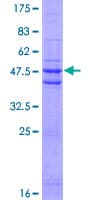 Human Dermatopontin / DPT Protein (Recombinant GST)